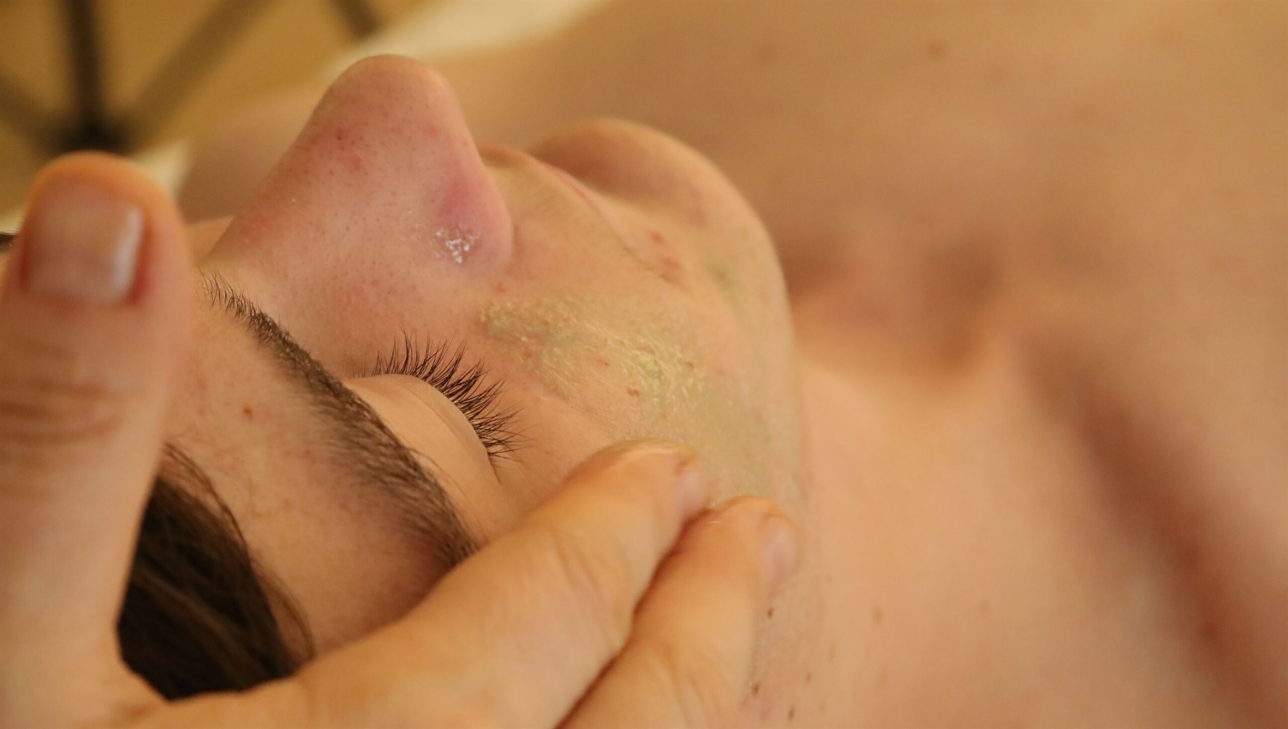 Limpieza facial teenager ret 1 scaled