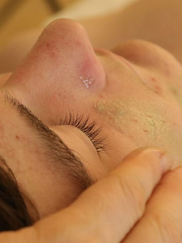 Limpieza facial teenager ret e1692011205678