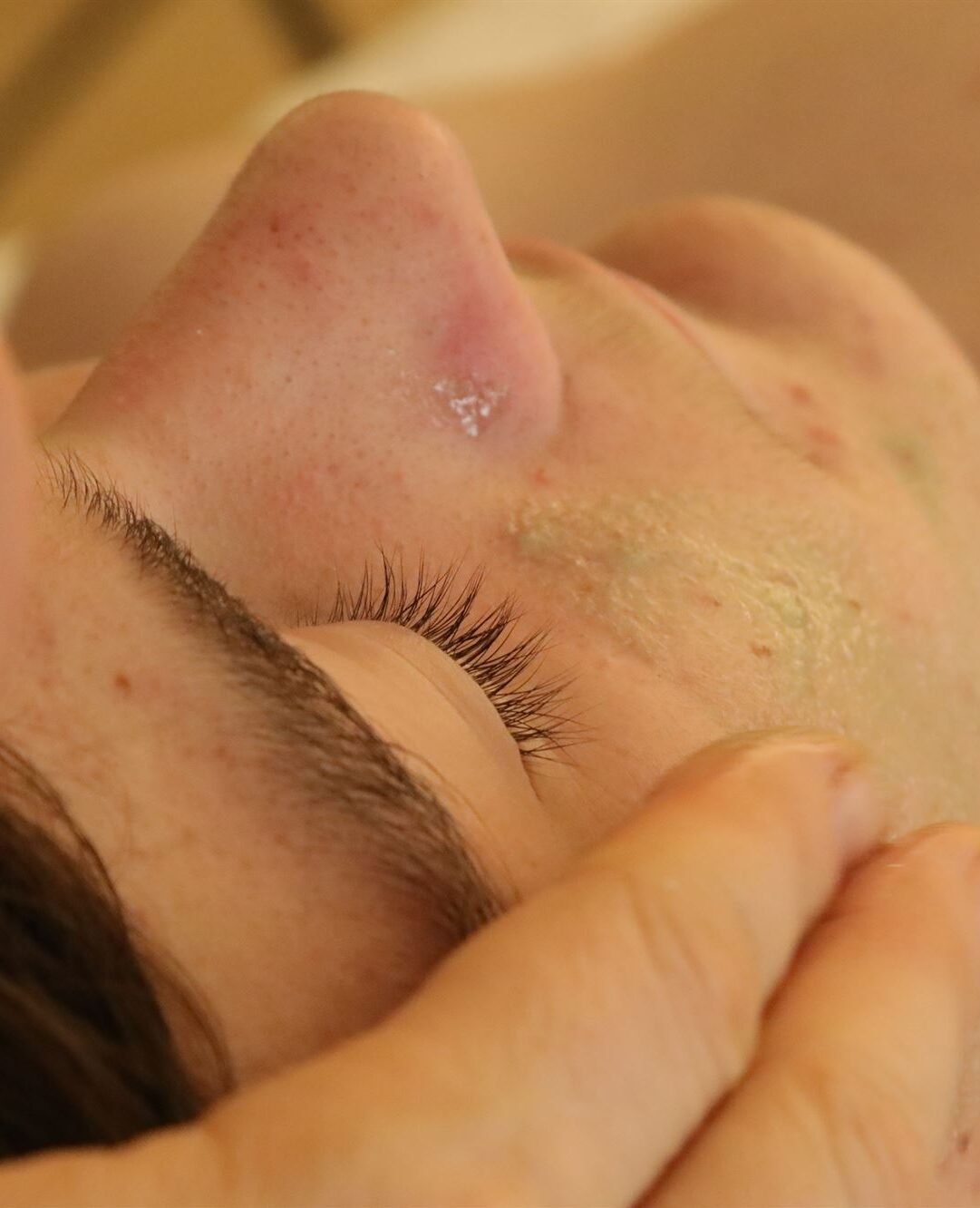 Limpieza facial teenager ret e1692011205678