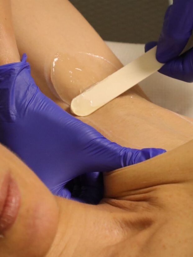 Depilacion laser ret e1692096919686