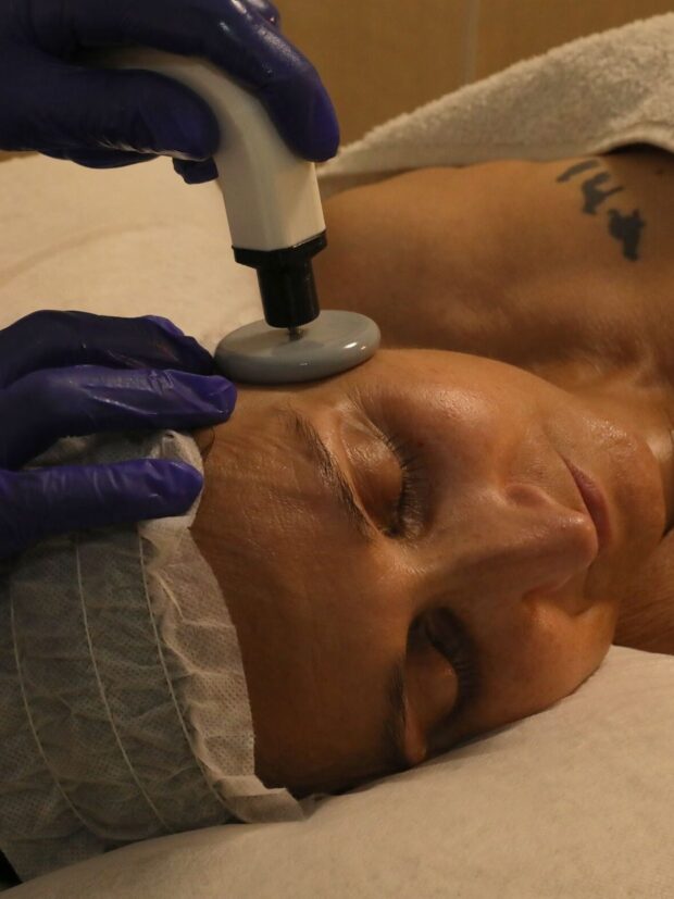 Fotorejuvenecimiento ret  e1692097023673